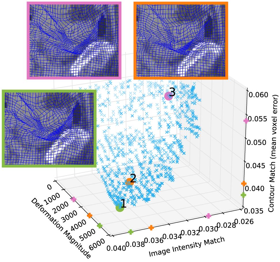 Pareto front of MOREA registrations with deformation grids of three solutions